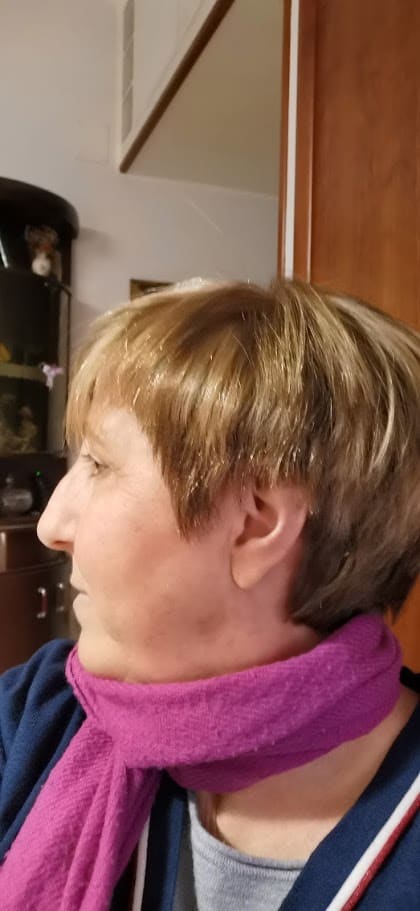 Biomineral One Lactocapil: ingredienti e se funziona davvero