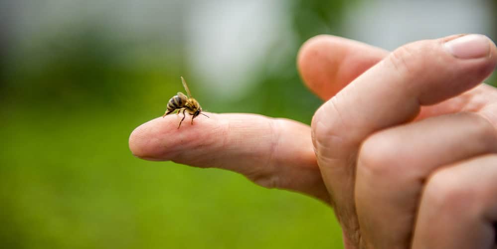 Puntura di ape con pungiglione da rimuovere. Insetto sulla mano umana, esempio di puntura di insetto, con sfondo verde sfocato.