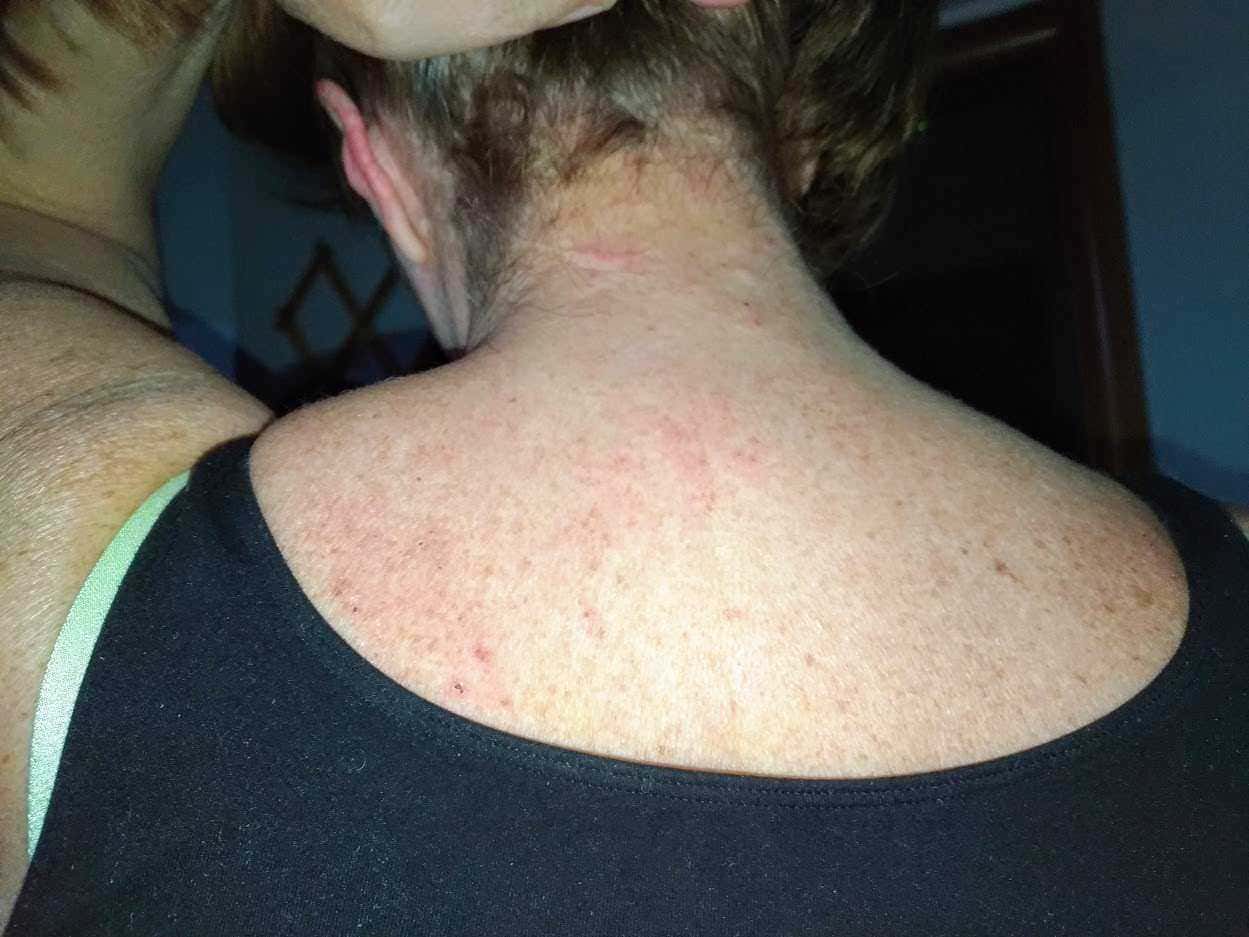 Bioderma Atoderm, migliore rimedio per pelle secca e irritata