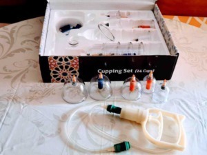 Set di bicchieri per il prelievo del sangue con pipette e siringa, contenuti in scatola per laboratorio medico, sul tavolo con tovaglia chiara.