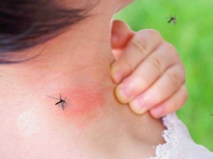 Piccolo bambino che si gratta il collo con zanzare intorno in un prato verde.