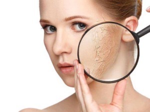 Pelle secca e screpolata, donna che utilizza lente d'ingrandimento per evidenziare le peeling o screpolature della pelle del viso, trattamento e cura della pelle.