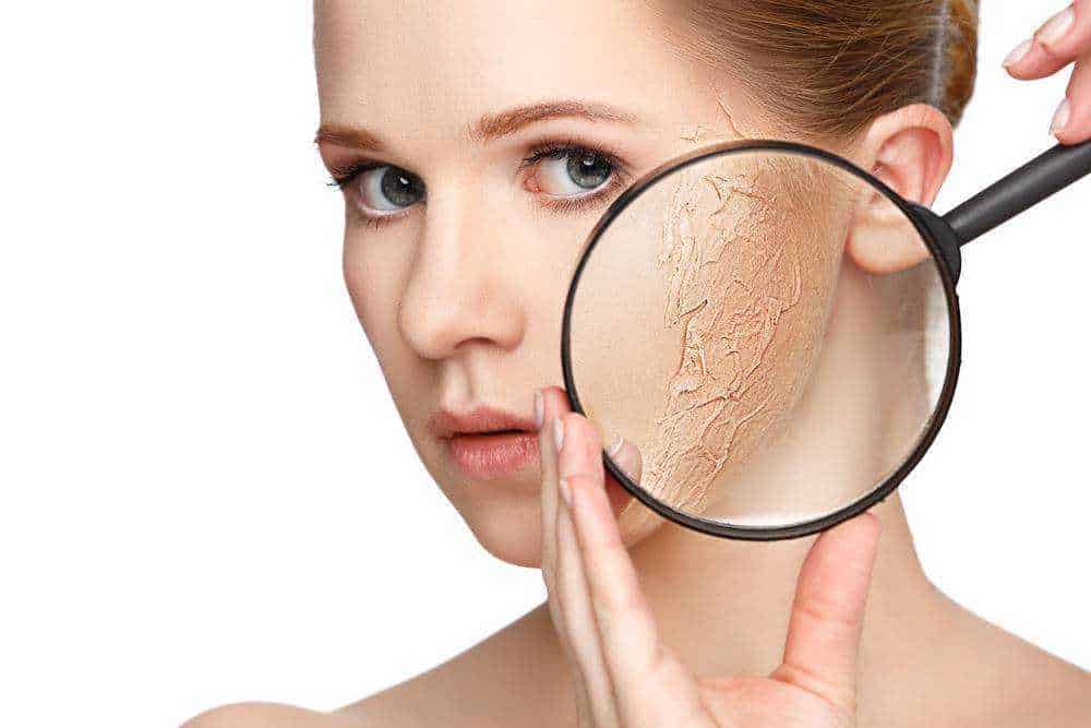 Pelle secca e screpolata, donna che utilizza lente d'ingrandimento per evidenziare le peeling o screpolature della pelle del viso, trattamento e cura della pelle.