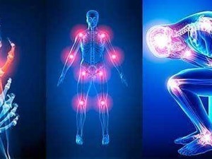 Un'immagine di anatomia umana e articolazioni doloranti in tecnologia 3D.