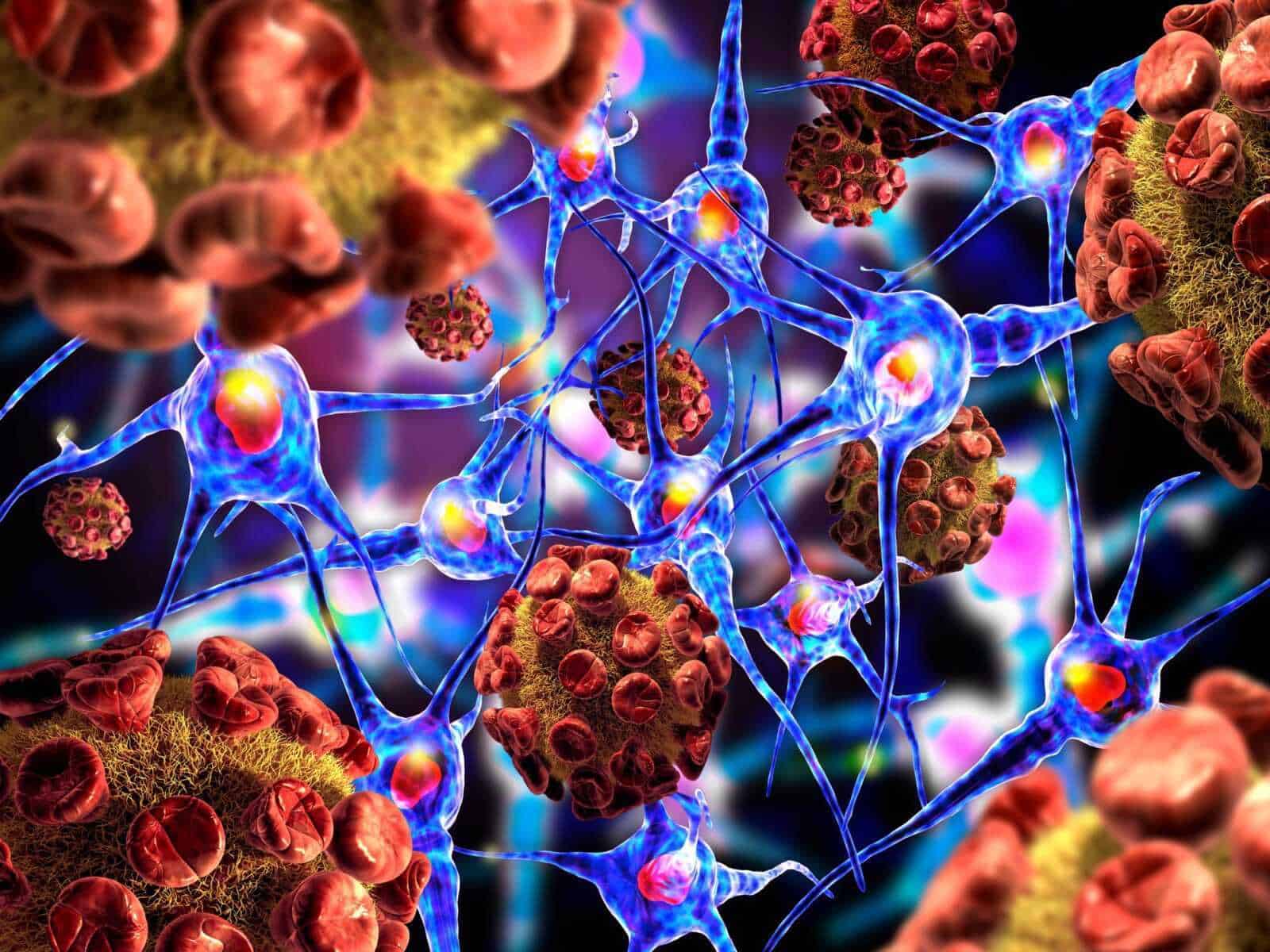 10 malattie autoimmuni gravi: quali sono e quali esami fare. 