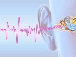 Acuto senso dell'udito rappresentato con un orecchio umano, impianto cocleare e onde sonore rosa. Immagine illustrativa per tecnologie uditive, salute dell'udito e innovazioni medicali.