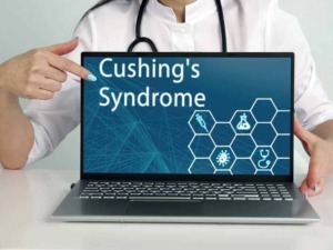 Cushing's Syndrome, malattia endocrinologica, con immagini di laboratorio, cure e sintomi, diagnosi, e trattamento medico. Tocco di un professionista in ambito sanitario, con design tecnologico.
